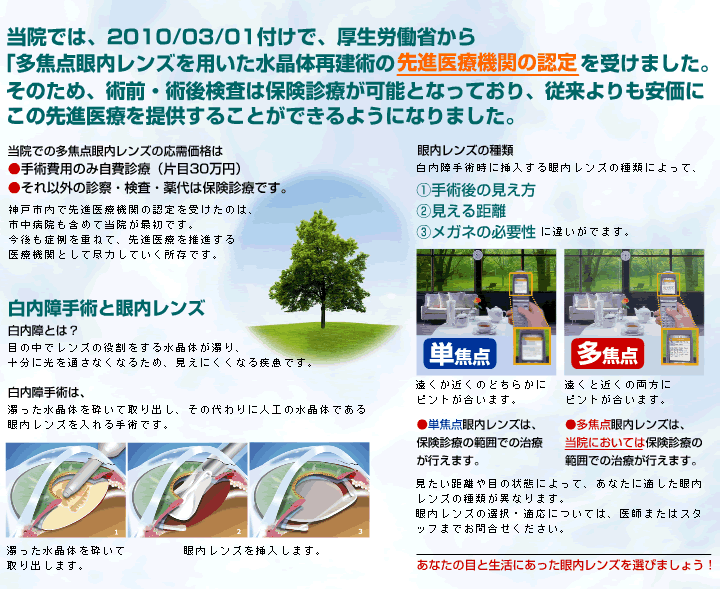 多焦点眼内レンズ